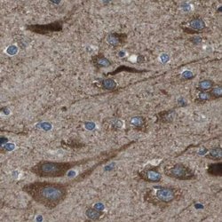 Invitrogen ARFGAP2 Polyclonal Antibody 100 &mu;L; Unconjugated:Antibodies,