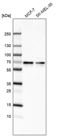 Invitrogen ARFGAP2 Polyclonal Antibody 100 &mu;L; Unconjugated:Antibodies,