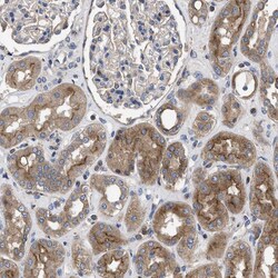 Invitrogen YBEY Polyclonal Antibody 100 &mu;L; Unconjugated:Antibodies,