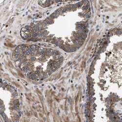 Invitrogen YBEY Polyclonal Antibody 100 &mu;L; Unconjugated:Antibodies,