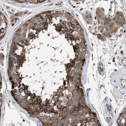 Invitrogen YBEY Polyclonal Antibody 100 &mu;L; Unconjugated:Antibodies,