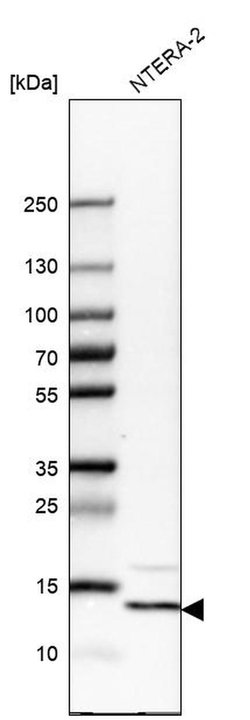 Invitrogen YBEY Polyclonal Antibody 100 &mu;L; Unconjugated:Antibodies,