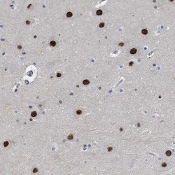 Invitrogen ENT2 Polyclonal Antibody 100 &mu;L; Unconjugated:Antibodies,