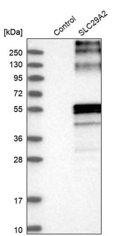 Invitrogen ENT2 Polyclonal Antibody 100 &mu;L; Unconjugated:Antibodies,