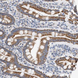 Invitrogen GRPEL2 Polyclonal Antibody 100 &mu;L; Unconjugated:Antibodies,