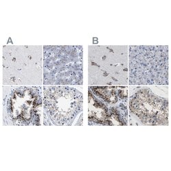 Invitrogen TMEM87A Polyclonal Antibody 100 &mu;L; Unconjugated:Antibodies,
