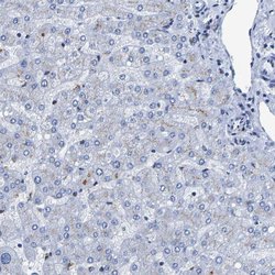 Invitrogen TMEM87A Polyclonal Antibody 100 &mu;L; Unconjugated:Antibodies,