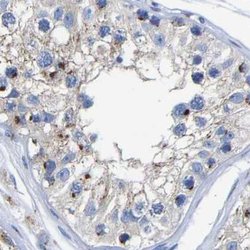 Invitrogen TMEM87A Polyclonal Antibody 100 &mu;L; Unconjugated:Antibodies,