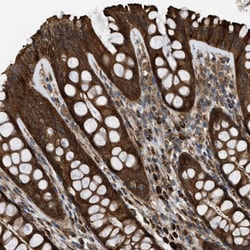 Invitrogen SESN2 Polyclonal Antibody 100 &mu;L; Unconjugated:Antibodies,