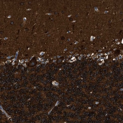 Invitrogen ZSWIM5 Polyclonal Antibody 100 &mu;L; Unconjugated:Antibodies,