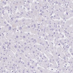 Invitrogen GUCA2A Polyclonal Antibody 100 &mu;L; Unconjugated:Antibodies,