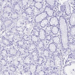 Invitrogen GUCA2A Polyclonal Antibody 100 &mu;L; Unconjugated:Antibodies,