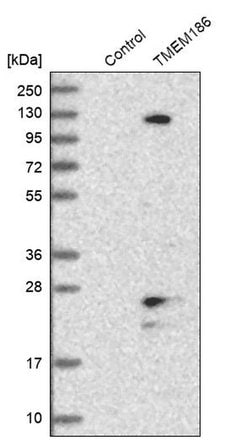 Invitrogen TMEM186 Polyclonal Antibody 100 &mu;L; Unconjugated:Antibodies,