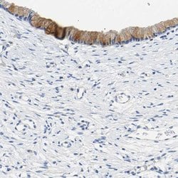 Invitrogen CHAD Polyclonal Antibody 100 &mu;L; Unconjugated:Antibodies,