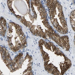 Invitrogen NDRG3 Polyclonal Antibody 100 &mu;L; Unconjugated:Antibodies,