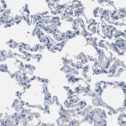 Invitrogen MIS18A Polyclonal Antibody 100 &mu;L | Buy Online | Invitrogen&trade; | Fisher Scientific