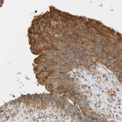 Invitrogen CEP57 Polyclonal Antibody 100 &mu;L; Unconjugated:Antibodies,