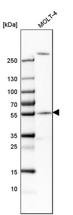 Invitrogen CEP57 Polyclonal Antibody 100 &mu;L; Unconjugated:Antibodies,