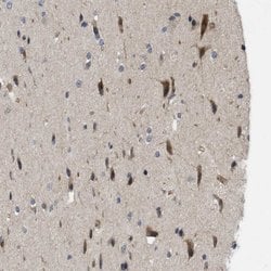 Invitrogen CALHM1 Polyclonal Antibody 100 &mu;L; Unconjugated:Antibodies,