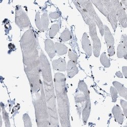 Invitrogen SFRS15 Polyclonal Antibody 100 &mu;L; Unconjugated:Antibodies,