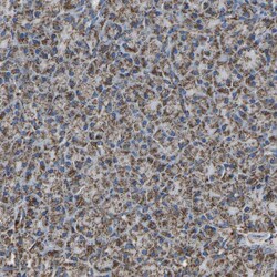 Invitrogen IRX6 Polyclonal Antibody 100 &mu;L | Buy Online | Invitrogen&trade; | Fisher Scientific