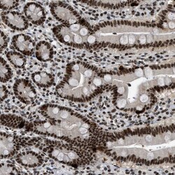 Invitrogen URB1 Polyclonal Antibody 100 &mu;L; Unconjugated:Antibodies,