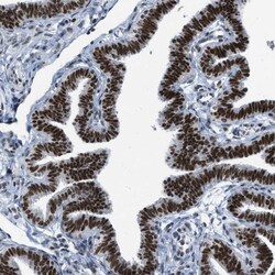 Invitrogen URB1 Polyclonal Antibody 100 &mu;L; Unconjugated:Antibodies,