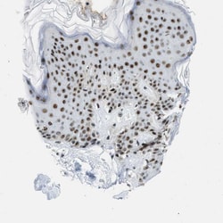 Invitrogen URB1 Polyclonal Antibody 100 &mu;L; Unconjugated:Antibodies,