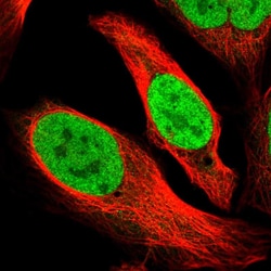 Invitrogen XPO5 Polyclonal Antibody 100 &mu;L; Unconjugated:Antibodies,
