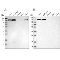 Invitrogen XPO5 Polyclonal Antibody 100 &mu;L; Unconjugated:Antibodies,
