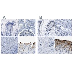 Invitrogen UPK3A Polyclonal Antibody 100 &mu;L; Unconjugated:Antibodies,