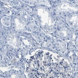 Invitrogen UPK3A Polyclonal Antibody 100 &mu;L; Unconjugated:Antibodies,