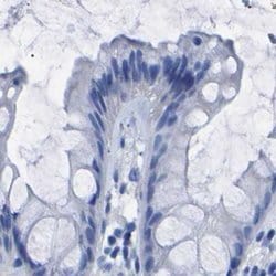Invitrogen UPK3A Polyclonal Antibody 100 &mu;L; Unconjugated:Antibodies,