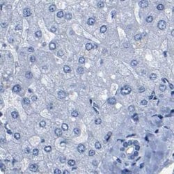 Invitrogen UPK3A Polyclonal Antibody 100 &mu;L; Unconjugated:Antibodies,