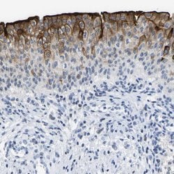 Invitrogen UPK3A Polyclonal Antibody 100 &mu;L; Unconjugated:Antibodies,