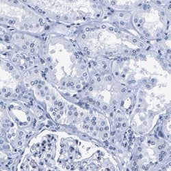 Invitrogen UPK3A Polyclonal Antibody 100 &mu;L; Unconjugated:Antibodies,