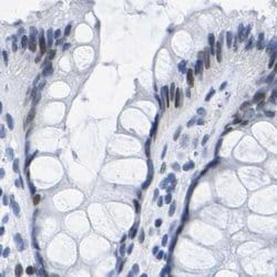 Invitrogen UPK3A Polyclonal Antibody 100 &mu;L; Unconjugated:Antibodies,