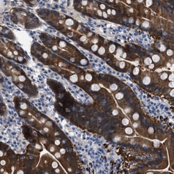 Invitrogen CBR1 Polyclonal Antibody 100 &mu;L; Unconjugated:Antibodies,