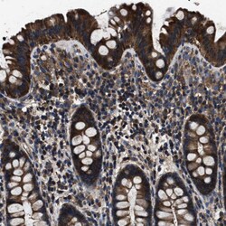 Invitrogen HSCB Polyclonal Antibody 100 &mu;L; Unconjugated:Antibodies,