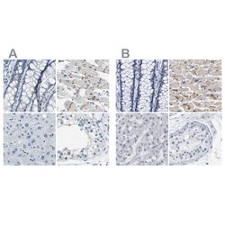 Invitrogen XIRP1 Polyclonal Antibody 100 &mu;L; Unconjugated:Antibodies,