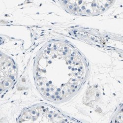 Invitrogen XIRP1 Polyclonal Antibody 100 &mu;L; Unconjugated:Antibodies,