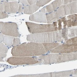 Invitrogen XIRP1 Polyclonal Antibody 100 &mu;L; Unconjugated:Antibodies,