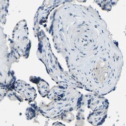 Invitrogen XIRP1 Polyclonal Antibody 100 &mu;L; Unconjugated:Antibodies,