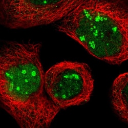 Invitrogen NOP58 Polyclonal Antibody 100 &mu;L; Unconjugated:Antibodies,