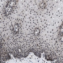 Invitrogen NOP58 Polyclonal Antibody 100 &mu;L; Unconjugated:Antibodies,