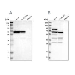 Invitrogen NOP58 Polyclonal Antibody 100 &mu;L; Unconjugated:Antibodies,