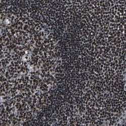 Invitrogen LUC7L3 Polyclonal Antibody 100 &mu;L; Unconjugated:Antibodies,