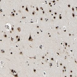 Invitrogen LUC7L3 Polyclonal Antibody 100 &mu;L; Unconjugated:Antibodies,