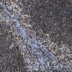 Invitrogen LUC7L3 Polyclonal Antibody 100 &mu;L; Unconjugated:Antibodies,