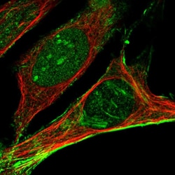 Invitrogen Septin 2 Polyclonal Antibody 100 &mu;L; Unconjugated:Antibodies,